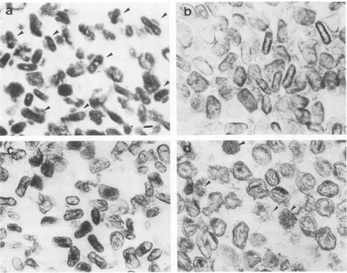 FIG.1.withacetic Thin-section electron micrographs of virus treated with detergents. (a) Virus treated with NP-40 + 2-ME