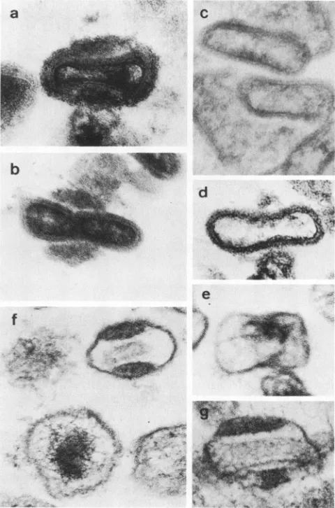 FIG. 2.fraction(c)MEwithBar, High magnification electron micrographs of virus treated detergents