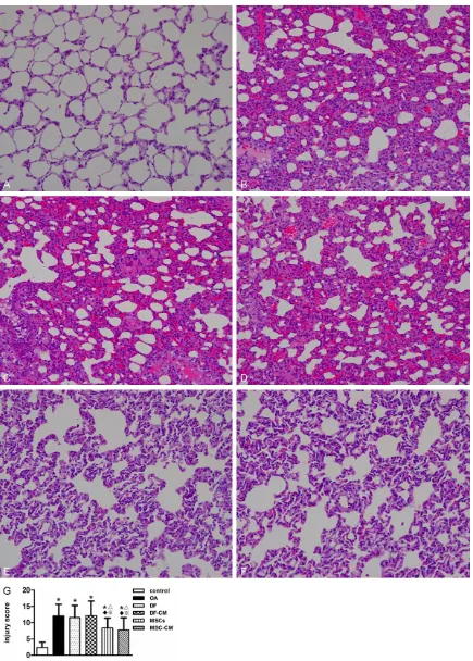Figure 1. MSCs and MSCs-CM restore lung structure following OA-induced ALI. Representative hematoxylin-eosin staining (HE) stained lung tissue from the following groups:control group (A); Oleic acid (OA) group (B); dermal fi-broblasts (DF) group (C); dermal fibroblasts condition medium (DF-CM) group (D); Mesenchymal stem cells (MSCs) group (E) Mesenchymal stem cells condition medium (MSC-CM) group (F) (original magnification ×100); and injure 