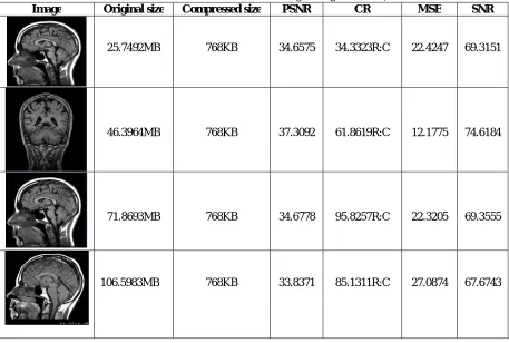 Table 1: PSNR and CR of medical images are given below; Original size Compressed size PSNR CR 
