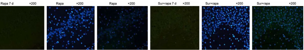 Figure 4. LC3B was mainly expressed in cytoplasm. Compared with Sur group, the expression of LC3B was stronger in Sur + Rapa group