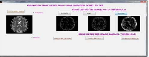 Figure 18: EDGE DETECTION ON LOW RESOLUTION IMAGE –BARBARA 