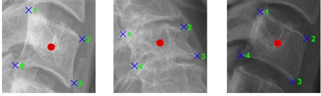 Figure 1: Vertebra corners (x) and centers (o)