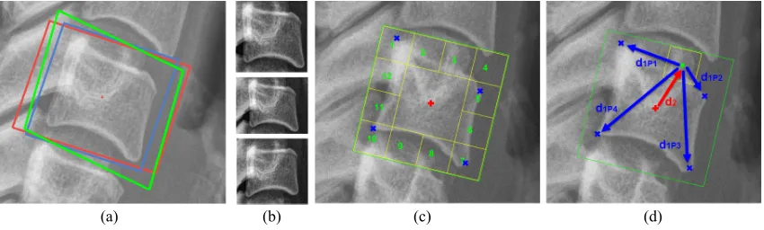 Figure 4: (a) Diﬀerent ROIs: Square (Blue), Rectangle (Red), Trapezoid (Green) (b) Vertebra inside diﬀerent ROI: Square(Top), Rectangle (Middle), Trapezoid (Bottom) and Patches: (c) Class labels and (d) Vectors.