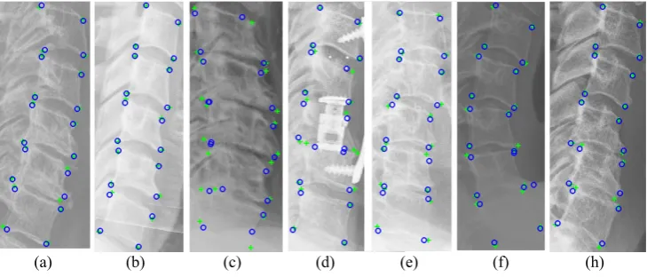 Figure 7: Vertebral corner prediction using fully convolutional network based probabilisticspatial regressor : ground truth (+), proposed prediction (o).