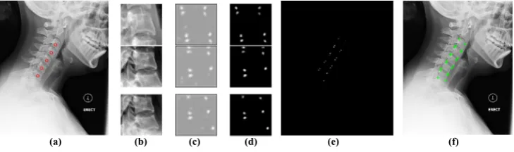 Figure 4: Post-processing (a) Input image with manually clicked vertebrae centers (b) Ex-tracted image patches to be forwarded through the network (c) Patch level prediction resultsfrom the network (d) Patch level predictions after removing residual probabilities (e) Imagelevel prediction (f) Localized corners.