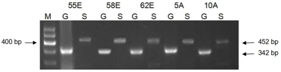 Figure 3. mRNA analysis of WWOX gene and GAPDH. M: Marker; A: Adjacent non-cancerous tissue; E: GCA tissue; G: GAPDH; W: WWOX.