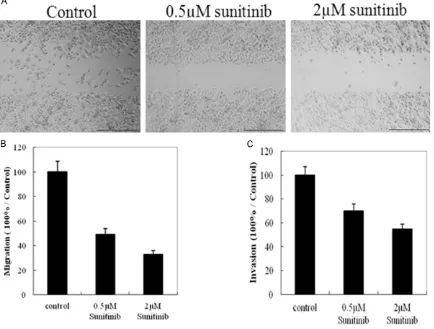 Figure 1. Effects of sunitinib on the ability of MCF-7 cell migration and invasion. Confluent 90% MCF-7 cells were wounded by 200 µl sterile pipette, then treated with varying concentrations of sunitinib for indicated time