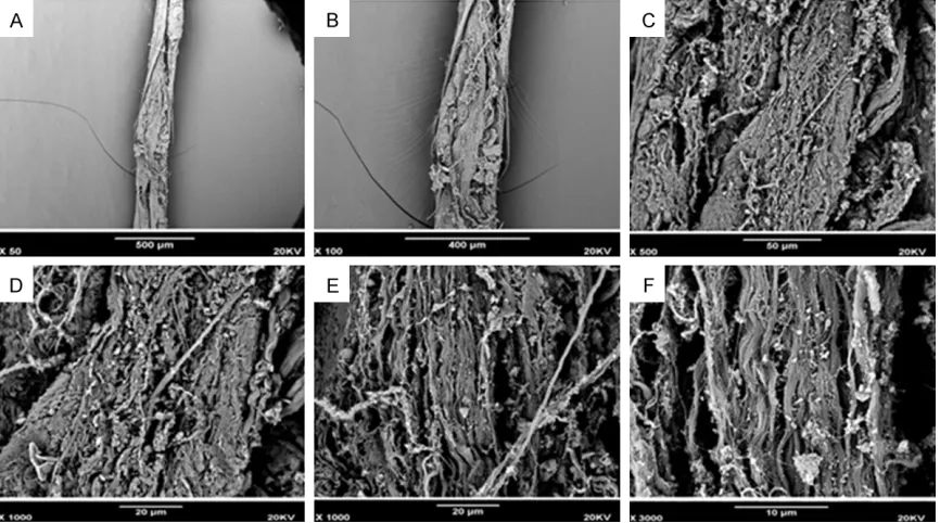 Figure 1. Early stage, SEM picture of FT belonging to specimen no. 1 with male, 12~13 gestational weeks