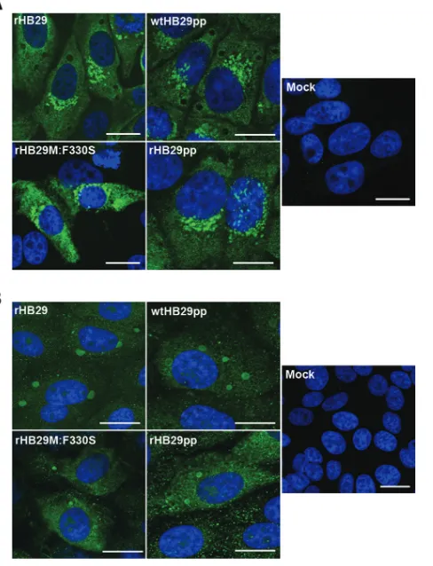 FIG 7 Intracellular localization of N and NSs proteins in infected cells. VeroE6 cells were infected at an MOI of 5 with rHB29, wtHB29pp, rHB29pp, orrHB29M:F330S or mock infected