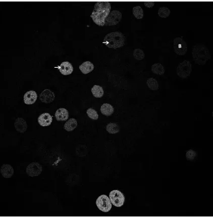 Figure 5. Representative frame of Fluo-N2DH-GOWT1 videos. The signal inside the cell nuclei 