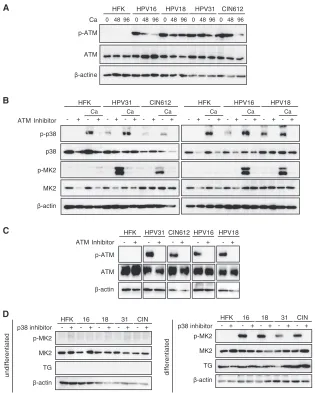 FIG 2 The ATM pathway is activated in HPV-positive cells, and addition of ATM inhibitors blocks induction of p-p38 and p-MK2