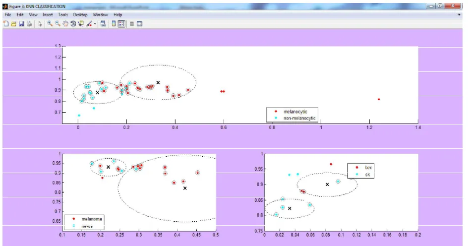 Figure 3.  KNN Classification 