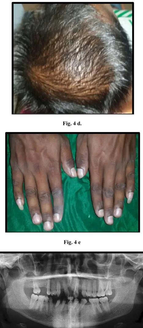 Fig. 4 d. 