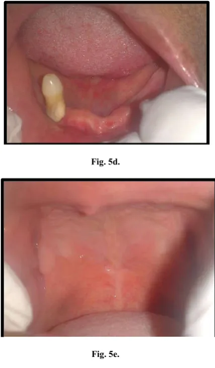 Fig. 5d. 