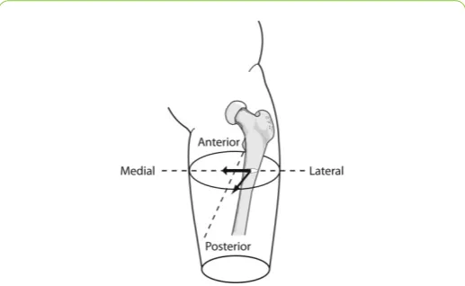 Figure 5: Femoral movement relative to the socket duringgait.