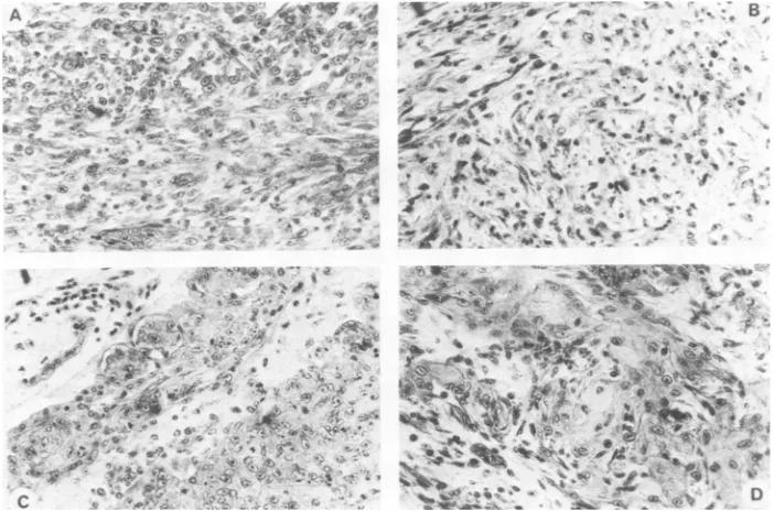 TABLE 4. Detection of plasminogen activator production in CEFmaintained in vitro and in tumor explants"