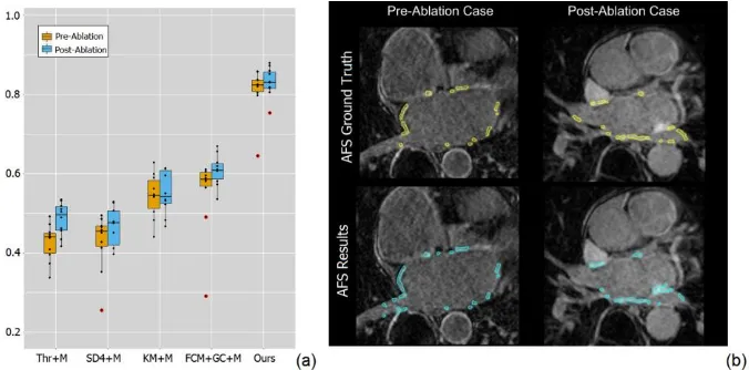 Fig. 2. (a) Boxplot for the comparison results of the Dice scores obtained by our fully automat-ic framework and other four methods (Thr, SD4, KM and FCM+GC) with manual delineated LA wall and PVs (+M); (b) Final AFS results (cyan regions) for an example p