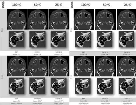 FIG 1. Noise-adapted image triplets (120 kV versus 100 kV: 3- versus 1-mm thickness) at tube-current-adjusted dose levels of 100%, 50%, and 25%,�which were evaluated by 7 readers regarding the subjective image quality