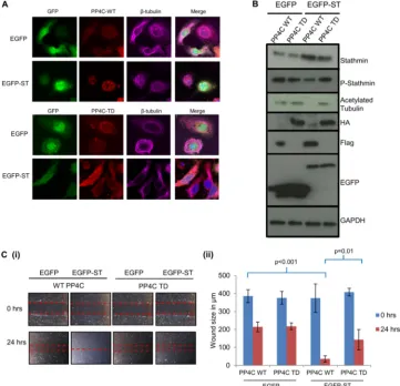 FIG 8 PP4C transdominant mutant expression inhibits MCPyV ST-mediated microtubule destabilization and cell motility