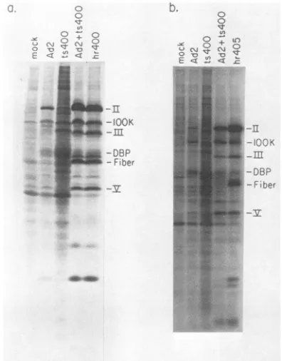FIG. 7.ofproductivecellselectrophoresis.infectedwereandvivowere Ad2ts400 Complementation between Ad2 and Ad2ts400 in monkey at the nonpermissive temperature