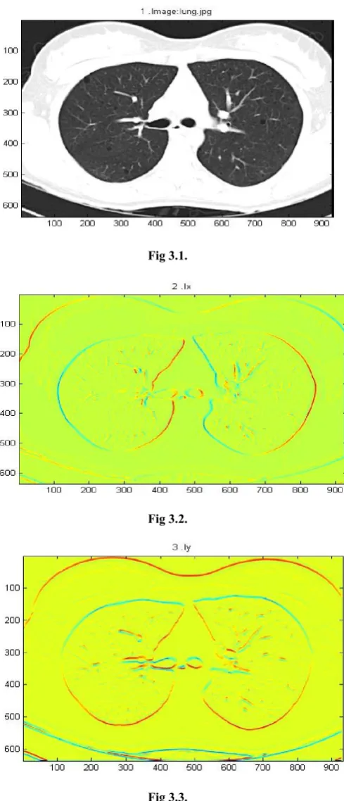Fig 3.1. 