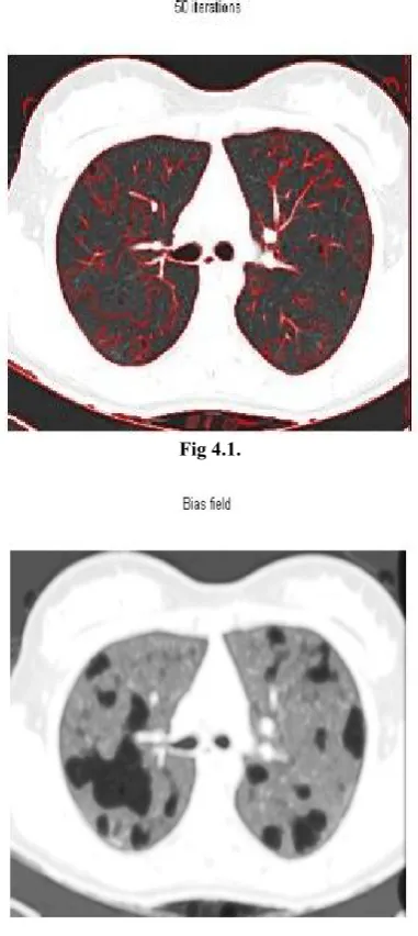 Fig 4.1. 
