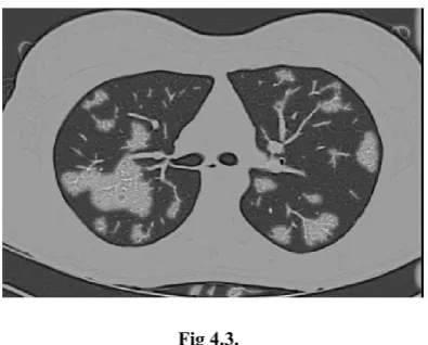 Fig 4.3.   