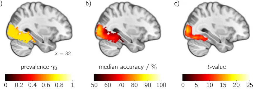 Figure 4: Second-level results for the classiﬁcation of object category of a visual stimulus (see— c)Cichy et al., 2011) shown in a sagittal slice through right lateral occipital cortex and fusiformgyrus