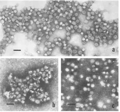 FIG. 2.fivefoldtext.particles Electron micrographs of purified particles from DHBV-containing duck serum