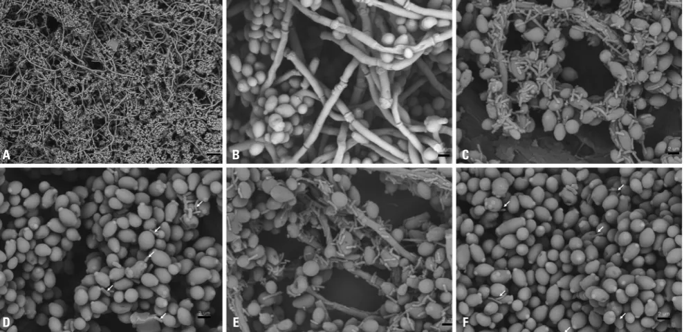 Fig. 5. Scanning electron microscopy of biofilms. killed bacteria. Magnifications are C