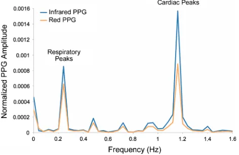 Fig. 1 Amplitude spectrum of normalized red and infrared PPGsignals recorded from a ventilated anaesthetised patient