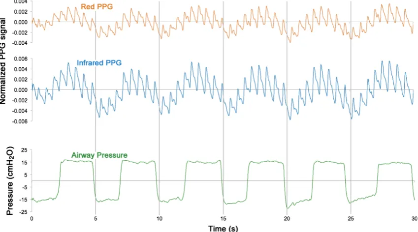 Fig. 2 30 s sample of red and infrared photoplethysmographic signals with simultaneously recorded airway pressures from one volunteer subjectduring timed forced breathing manoeuvre
