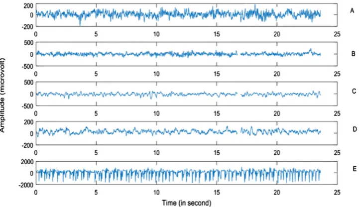 Fig. 3. An example of different EEG cases (A–E). 