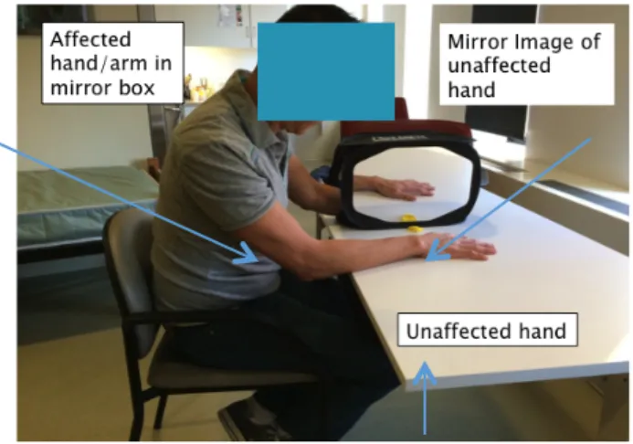 Figure 1. Mirror therapy set-up 