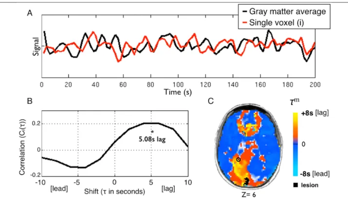 Figure 2-1 Using temporal cross-correlation to measure lag in resting state fMRI.   
