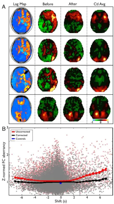 Figure 2-5. Lag disrupts functional connectivity but can be partially corrected.  
