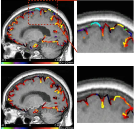 Figure 3-3. Identifying and correcting gray matter segmentation errors.  