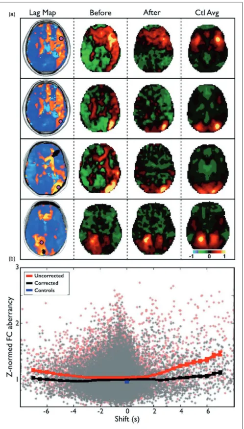 Figure 5. Lag disrupts functional connectivity but can be partially corrected. (a) Seed-based correlation maps for four ROIs in different locations that showed >2 s of lag