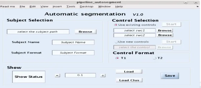 Figure 1.4 Main interface for automatic segmentation