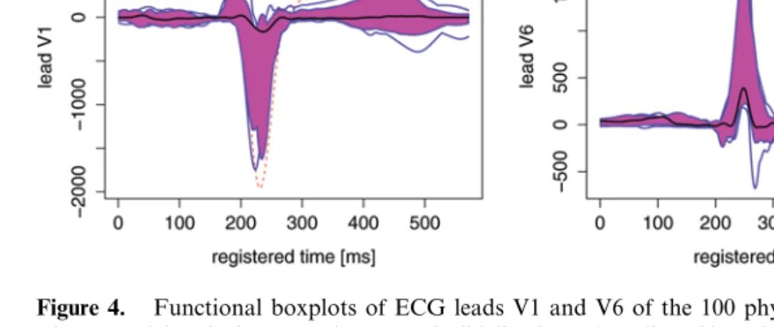 Figure 4. Functional boxplots of ECG leads V1 and V6 of the 100 physiological patients.
