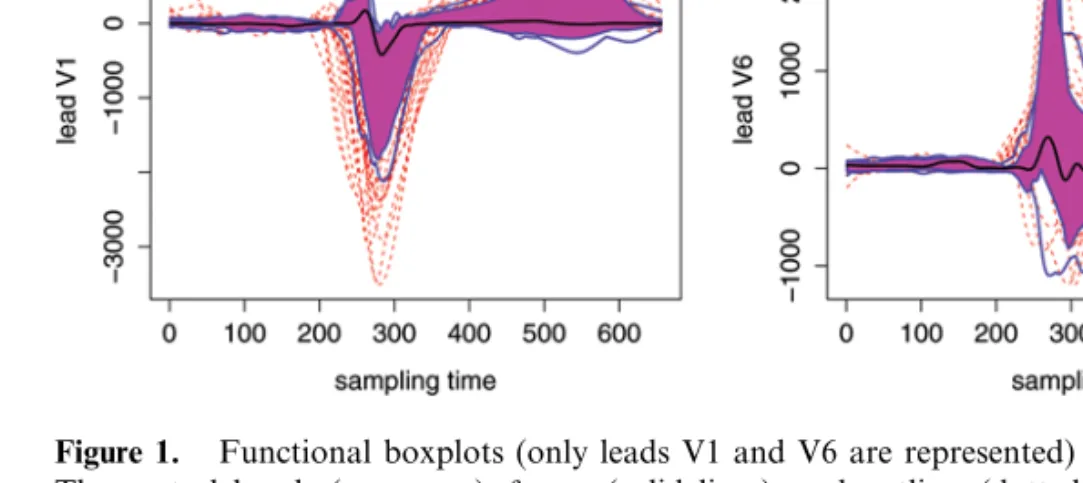 Figure 1. Functional boxplots (only leads V1 and V6 are represented) of 150 ECG traces.