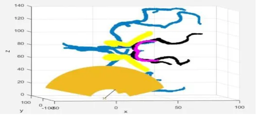 Fig. 3. Global search based on the sampling depth of ultrasound wave is 50 mm. 