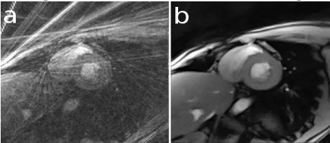 Figure 3: Reconstruction example over the MRI images  