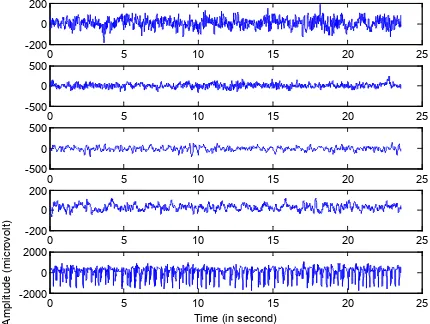 Fig. 1. Exemplary EEG signals from each of the five sets. (From top to bottom: Set A, Set B, Set C, Set D and Set E) 