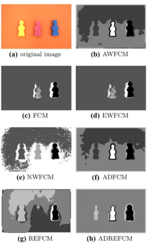 Fig. 7 Image segmentation experiments on X-ray output of a patient’s skull