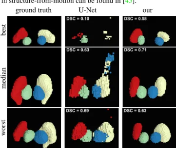 Figure 6. Left: Boxplot of the DSC of our method versus the U- U-Net segmentation. Right: Sorted DSC differences for the 16 cases (values above zero indicate an improvement upon U-Net).