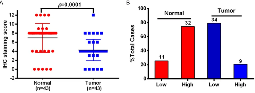 Figure 2. SIRT7 protein levels in 43thyroid carcinoma tissues and paired adjacent normal thyroid tissue as mea-sured by tissue microarray