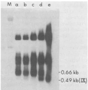 FIG. 11.ofDNA Fig. Densitometer scans of lanes a through d 10, hybridized to HindIlI C DNA (A) and SV40 (B).