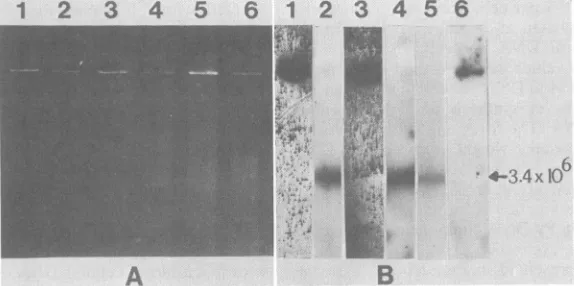 FIG.BEcoRI-treatedEcoRIbypatternsPysynthesizedtreated 28 agarose DNA digestion; DNA with of as L-celis
